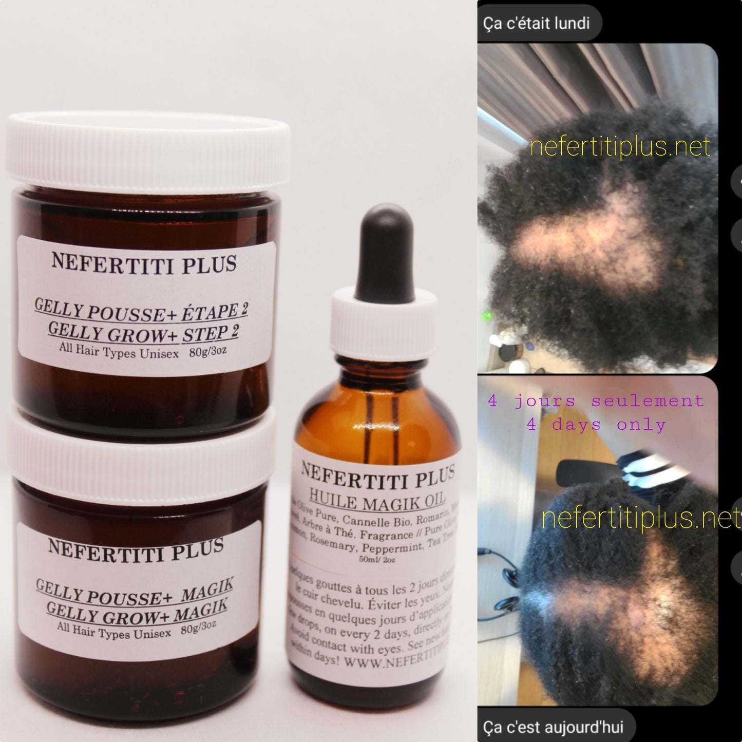 KIT COMPLET: ANTI-ALOPECIE SÉVÈRE NEFERTITI PLUS
