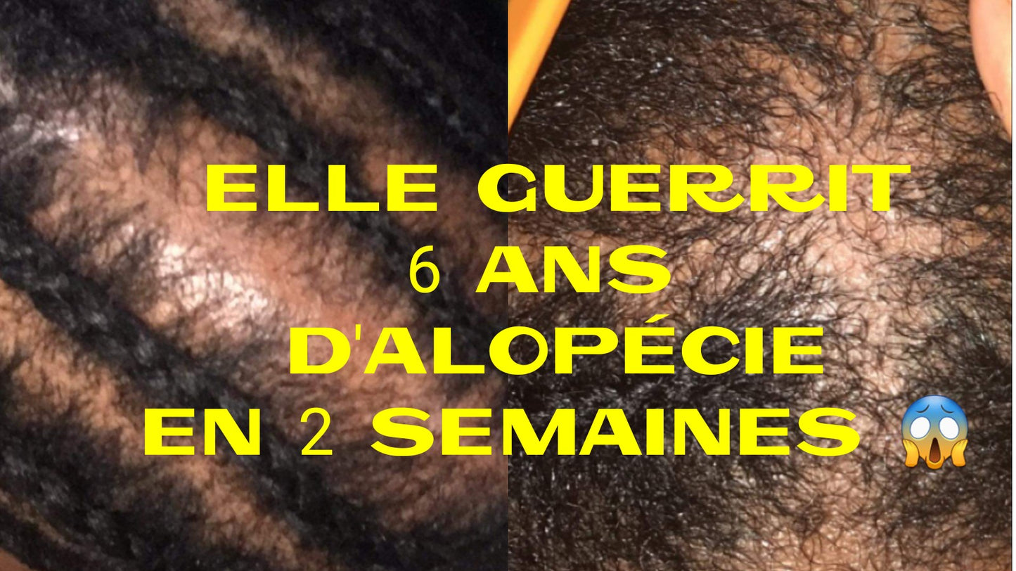 DUO ANTI-ALOPÉCIE NEFERTITI PLUS - Grand Format