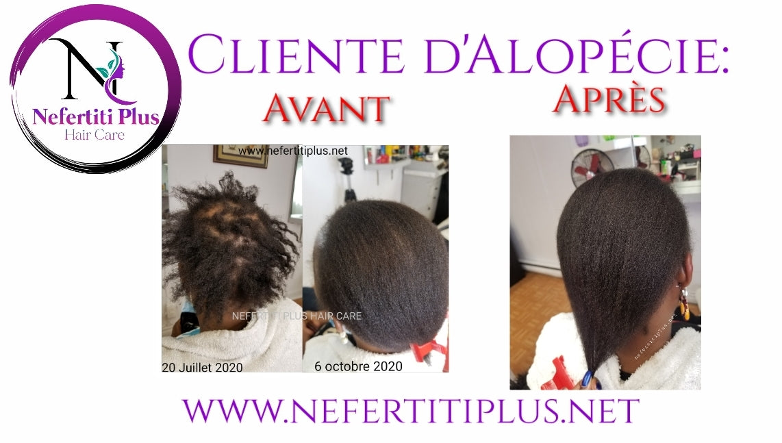 DUO ANTI-ALOPÉCIE NEFERTITI PLUS - Grand Format