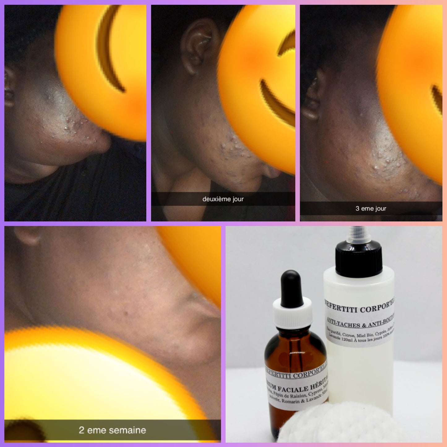 DUO ANTI-TÂCHES & ANTI-BOUTONS AVEC SÉRUM FACIALE